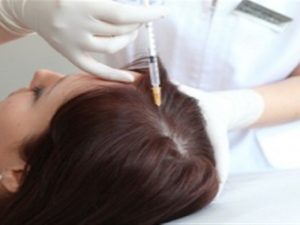 hair-regrowth-injections-1